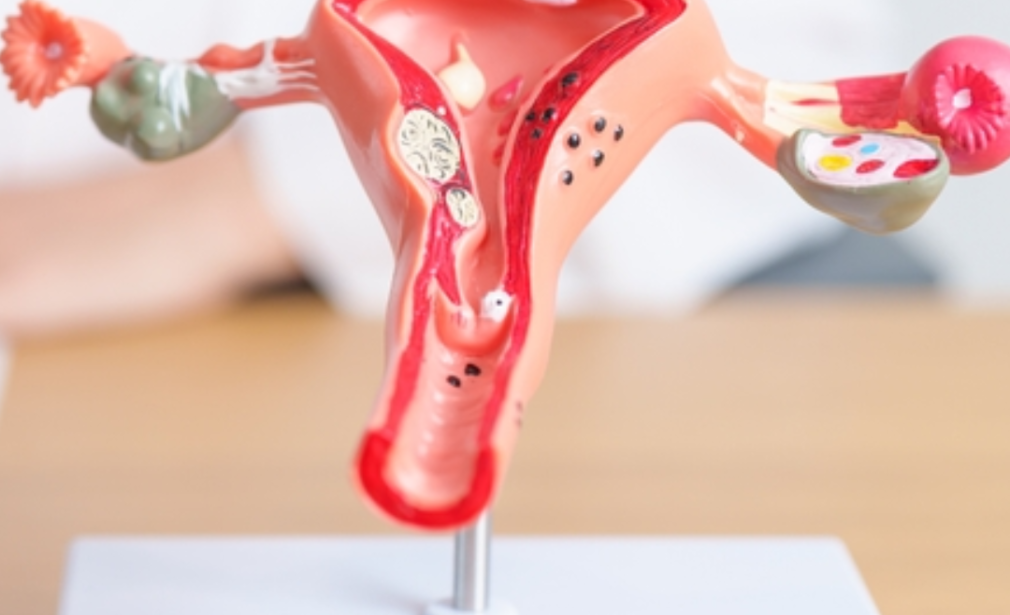 Hysterectomy Treatment Kolkata